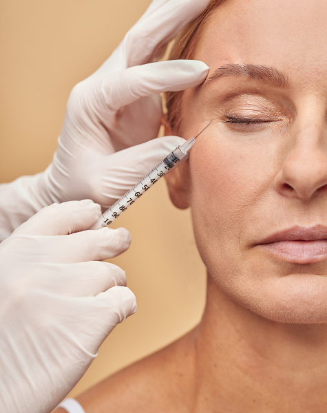 Aplicação de um bioestimulador de colagénio na zona periocular para tratamento de rugas e flacidez.